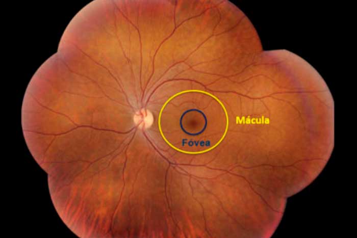 Retina y mácula. Enfermedades