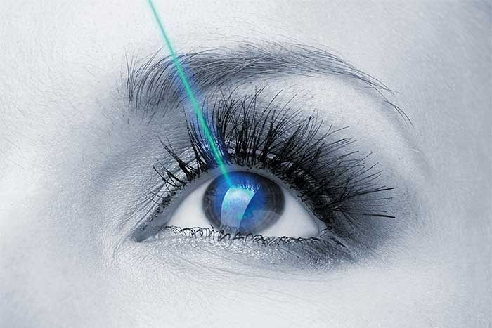Qué es y cómo se realiza la cirugía refractiva