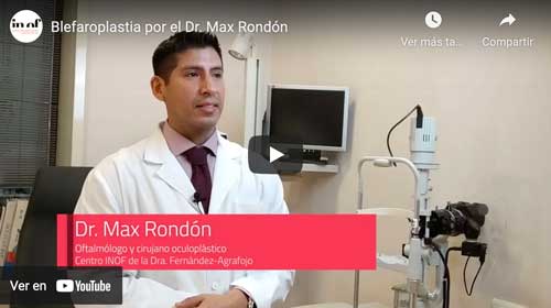 Vídeo de la blefaroplastia