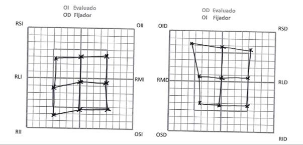 Videoculografía con GazeLab